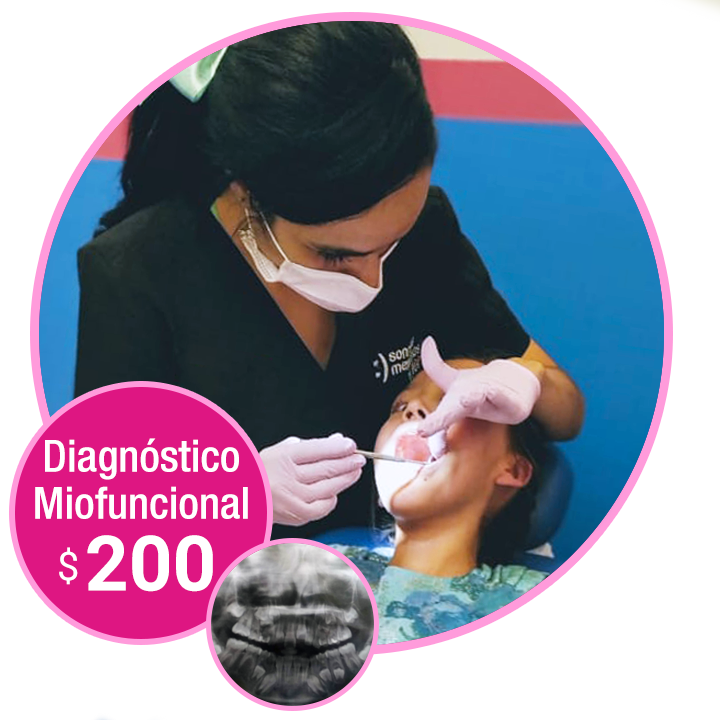Diagnóstico miofuncional 2