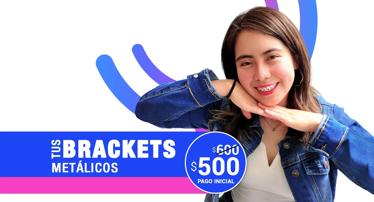 Brackets a buen precio en Sonrisas Mexicanas