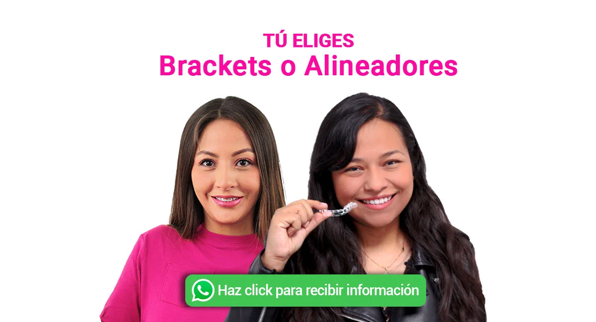 Brackets y Alineadores en Sonrisas Mexicanas