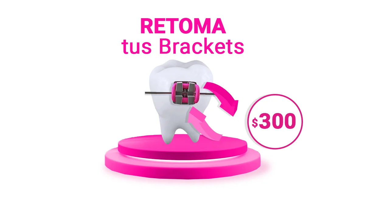 Brackets metálicos en Sonrisas Mexicanas