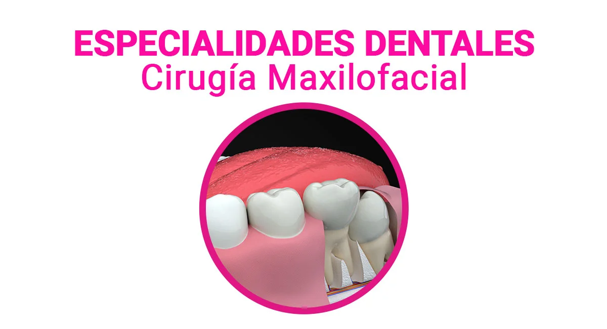 Cirugía Maxilofacial en Sonrisas Mexicanas