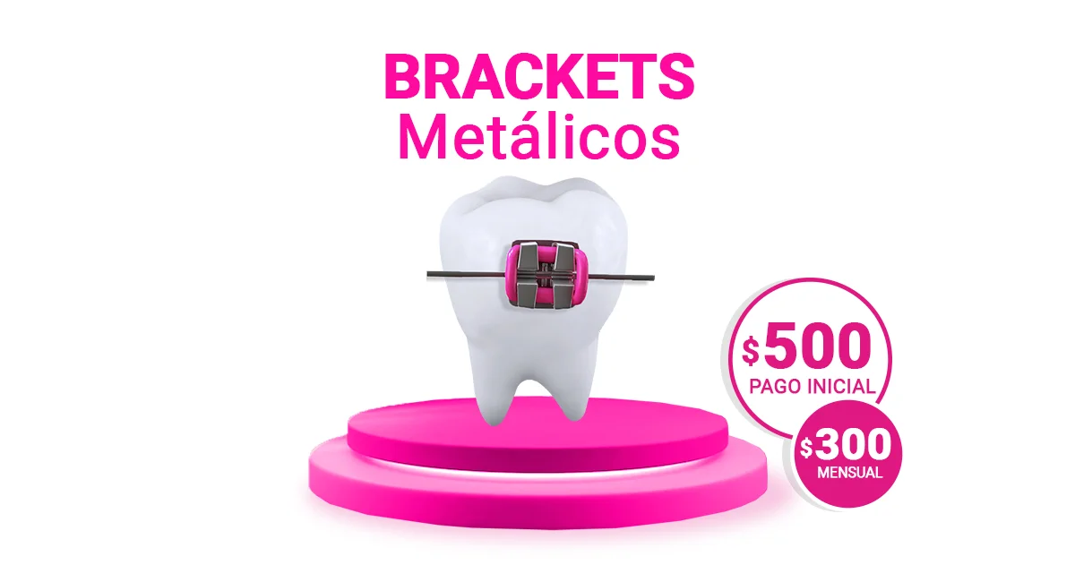 Brackets metálicos en Sonrisas Mexicanas