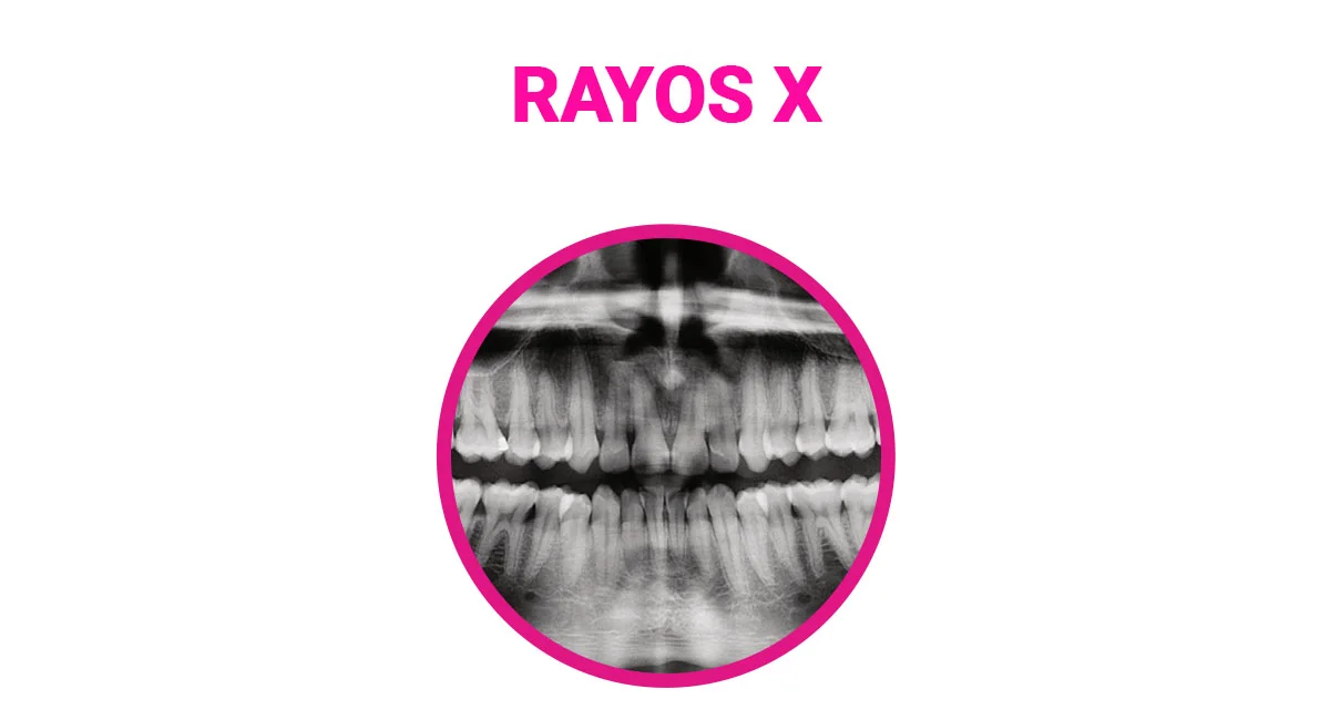 Rayos X en Sonrisas Mexicanas