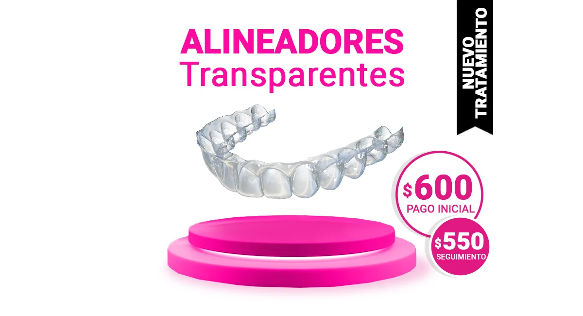 Alineadores-Sonrisas-Mexicanas