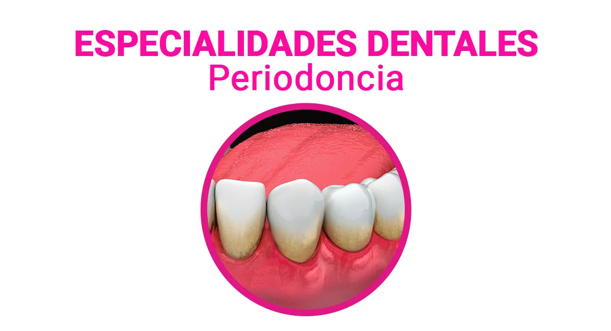 Periodoncia en Sonrisas Mexicanas