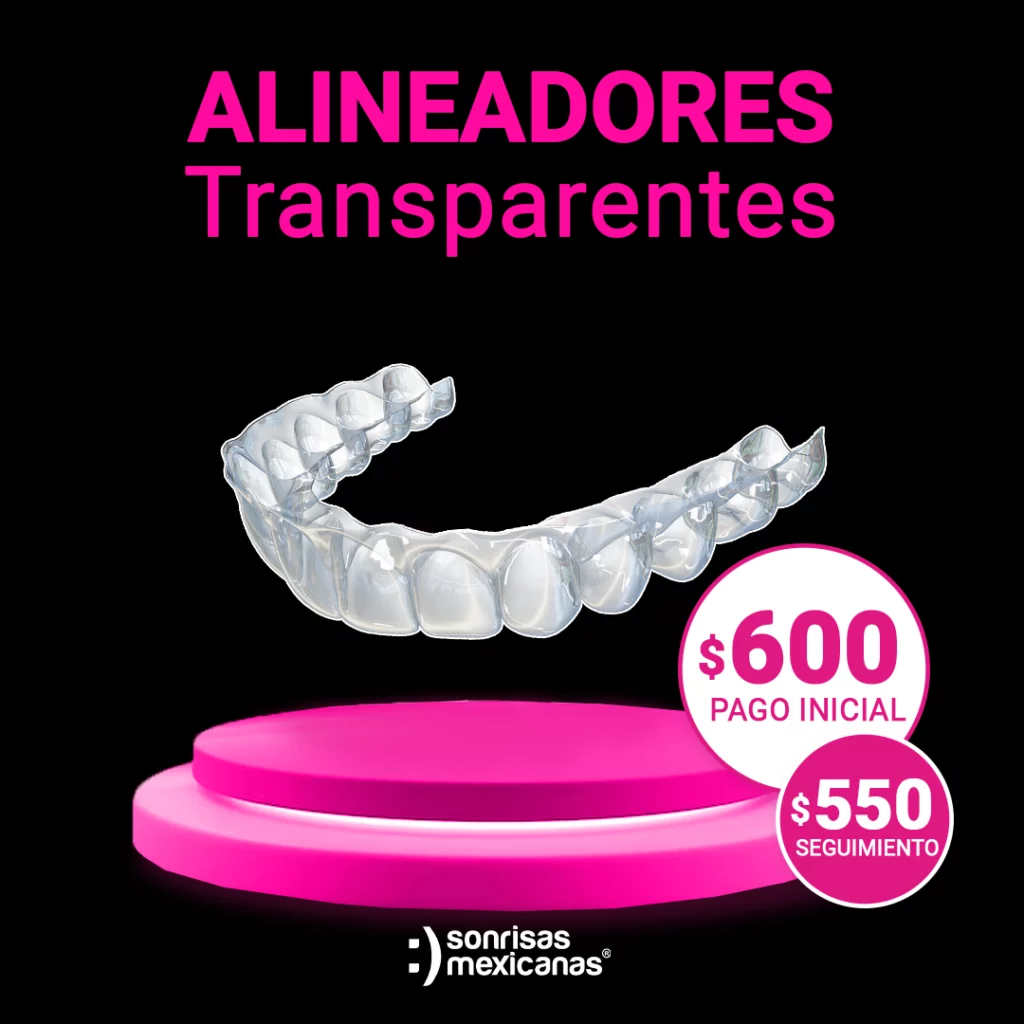 Alineadores Transparentes