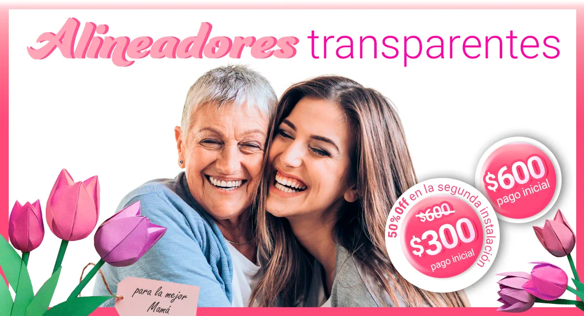 Alineadores transparentes en promocion en Sonrisas Mexicanas