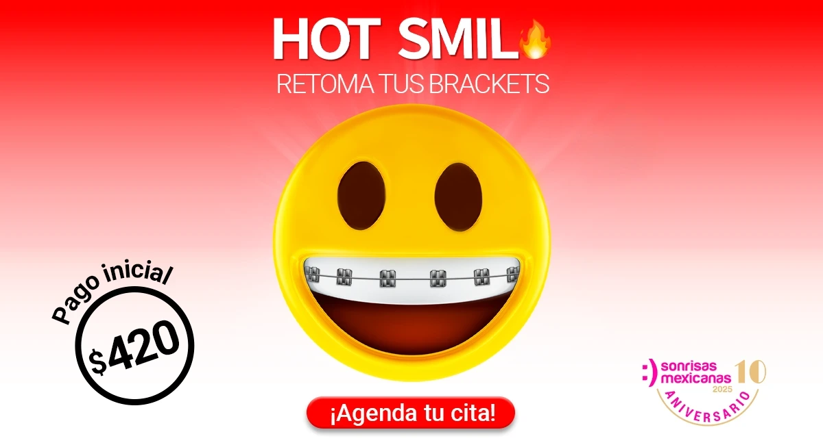 Brackets metálicos en Sonrisas Mexicanas