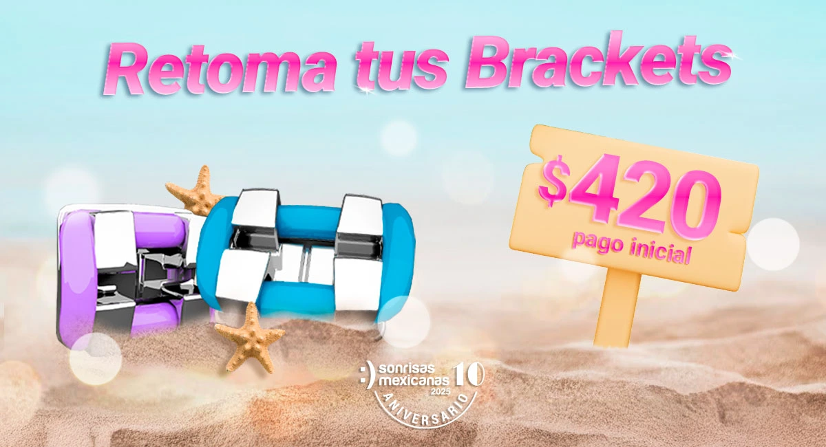 Brackets metálicos en Sonrisas Mexicanas