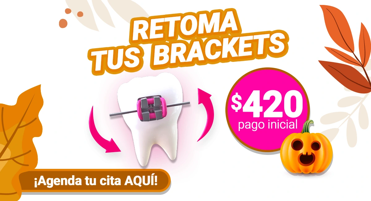 Brackets metálicos en Sonrisas Mexicanas