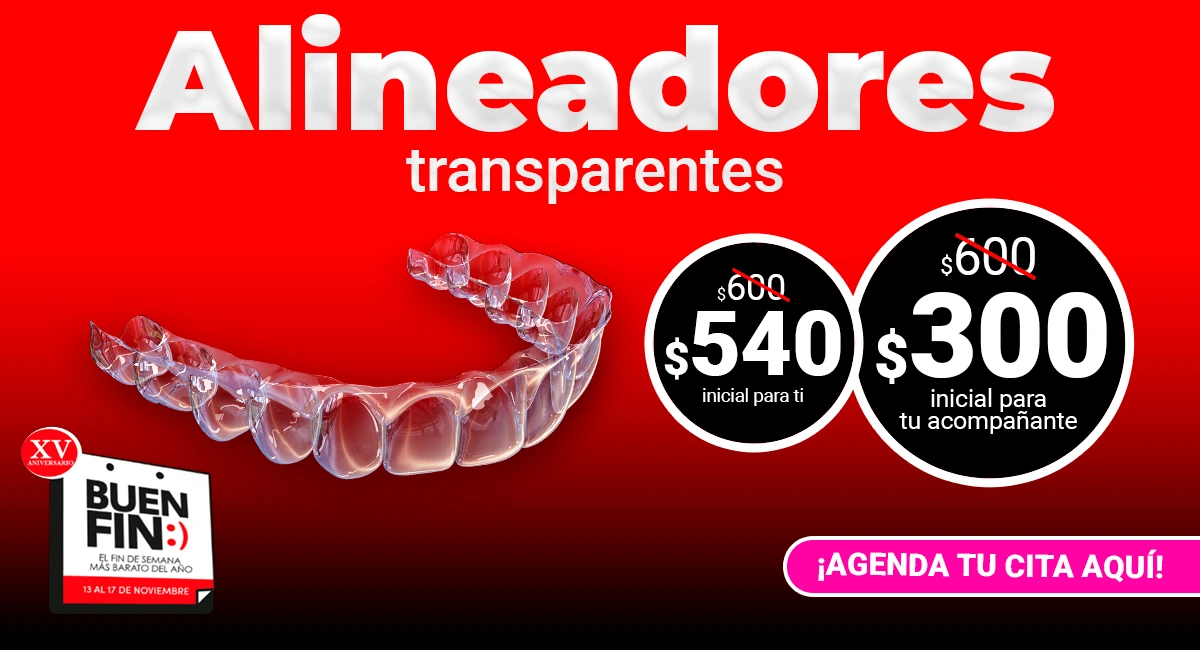 Alineacion Dental Transparente Clear en Sonrisas Mexicanas