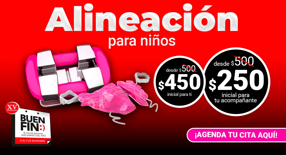 Alineación dental para niños