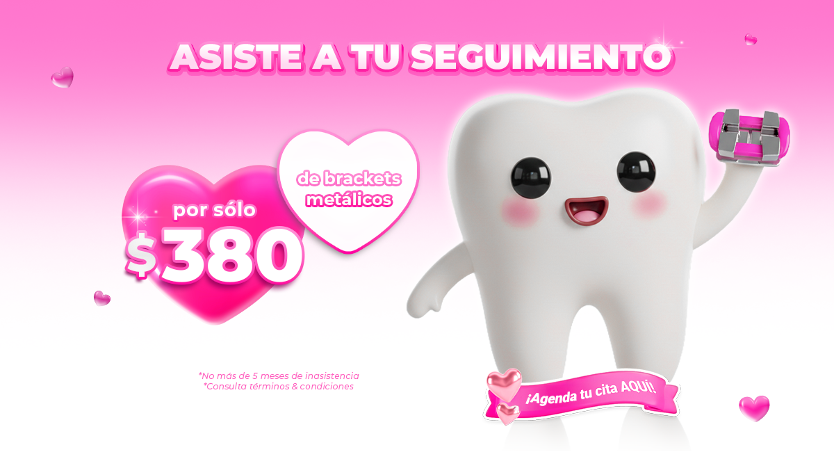 Brackets metálicos en Sonrisas Mexicanas