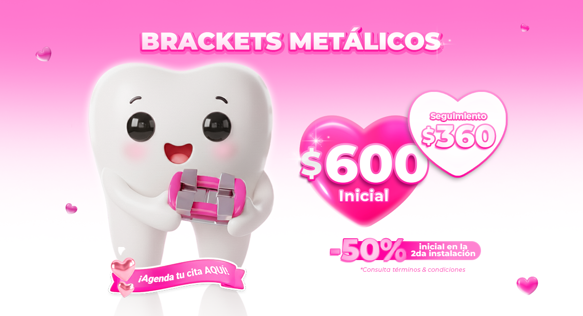 Alineadores-Sonrisas-Mexicanas