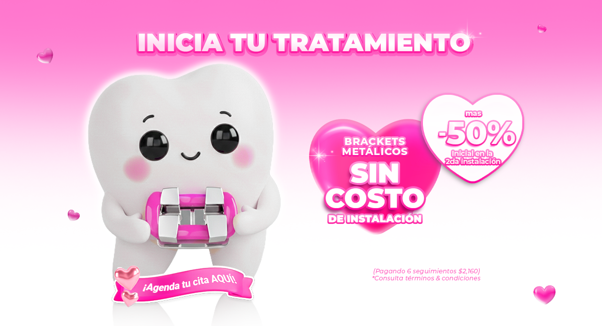 Brackets metálicos en Sonrisas Mexicanas