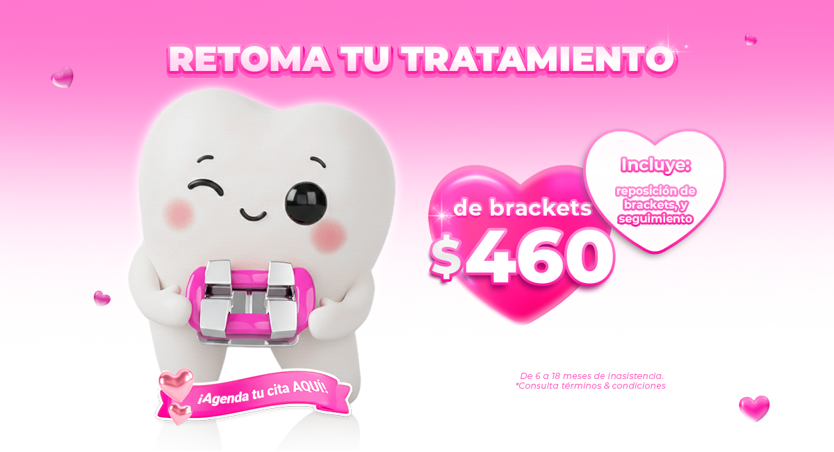 Brackets metálicos en Sonrisas Mexicanas