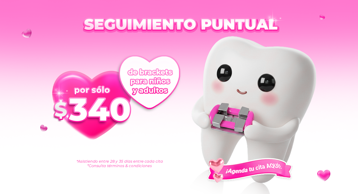 Brackets metálicos en Sonrisas Mexicanas