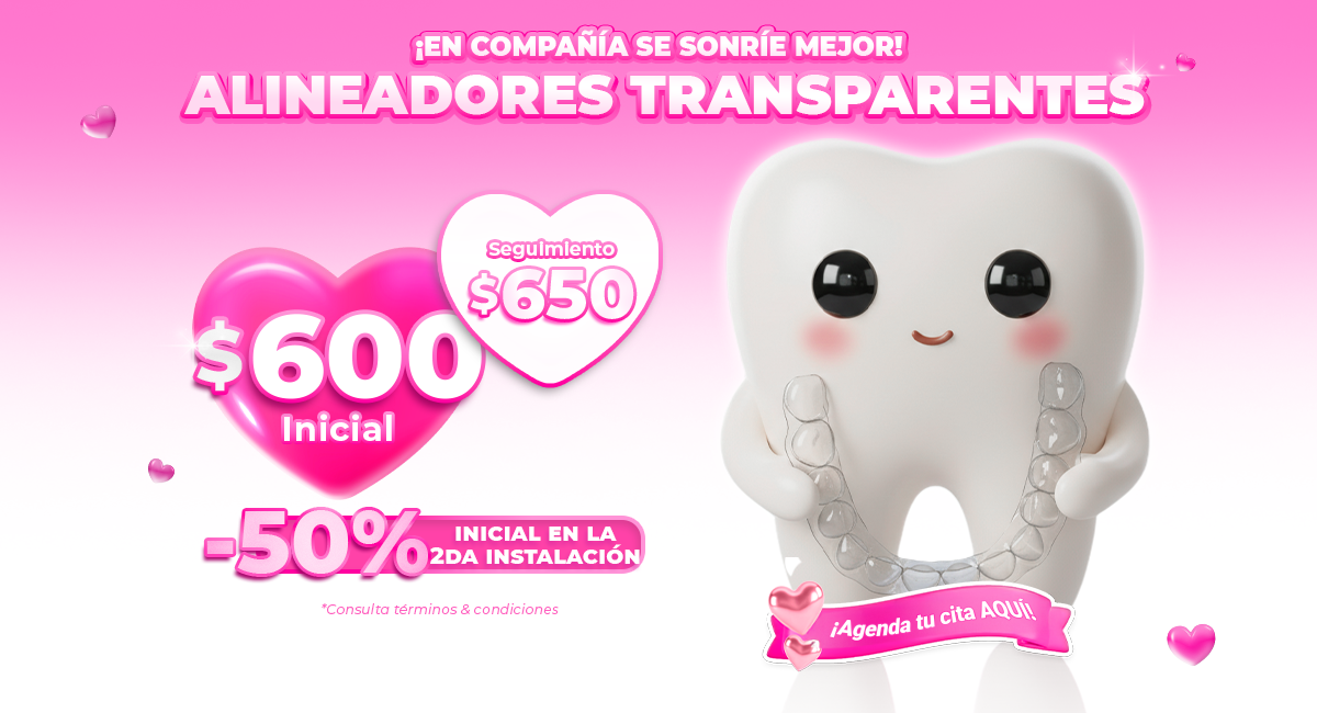 Alineacion Dental Transparente Clear en Sonrisas Mexicanas