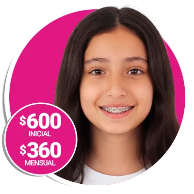 Diagnóstico miofuncional 2