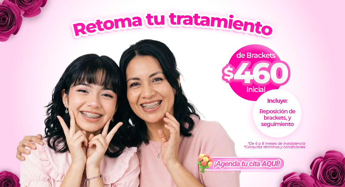 Brackets metálicos en Sonrisas Mexicanas