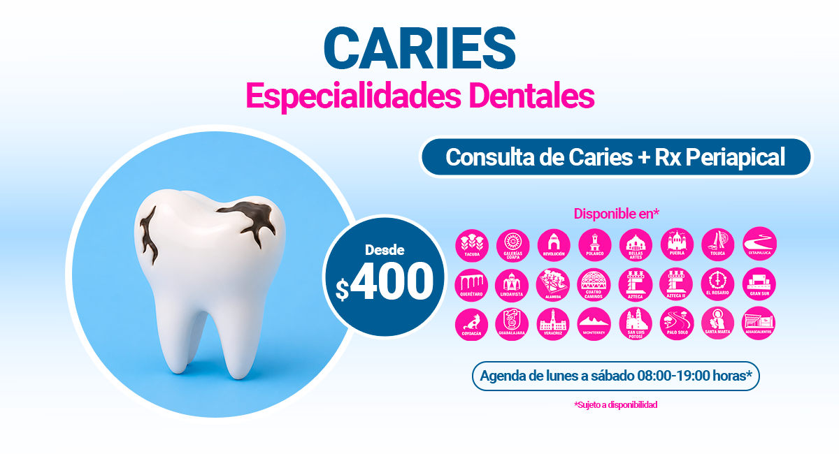 Tratamiento para Caries en Sonrisas Mexicanas