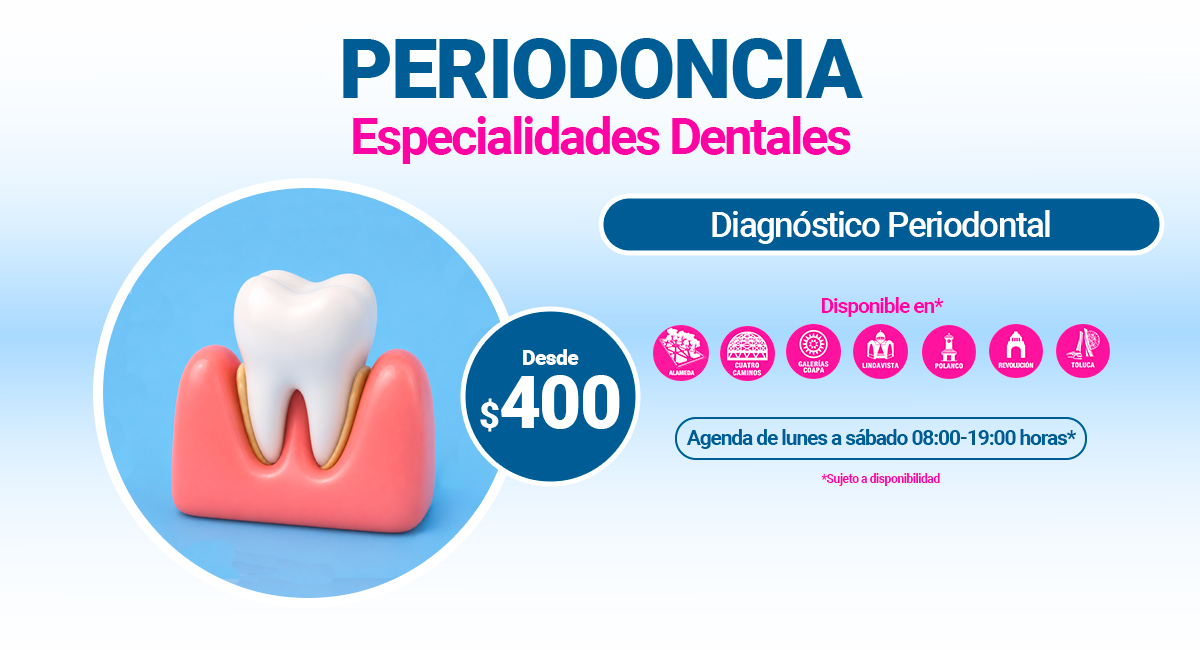 Periodoncia en Sonrisas Mexicanas