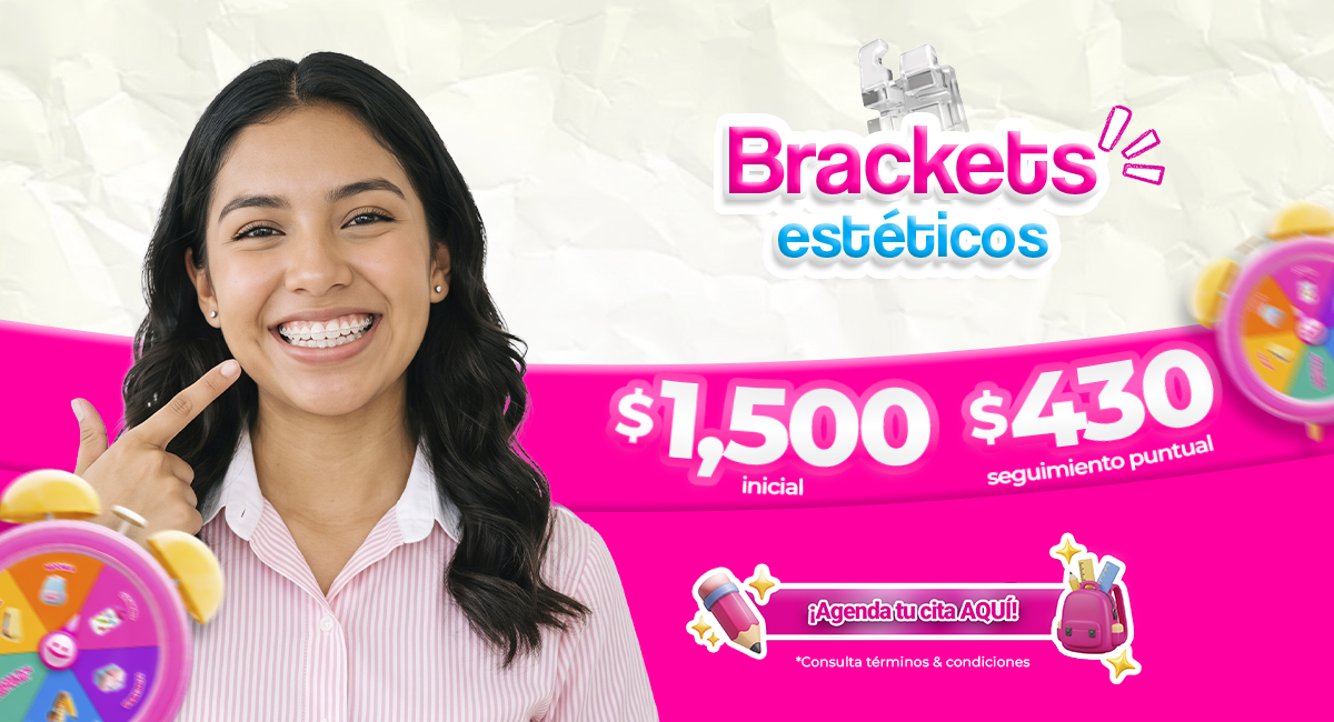 Brackets metálicos en Sonrisas Mexicanas