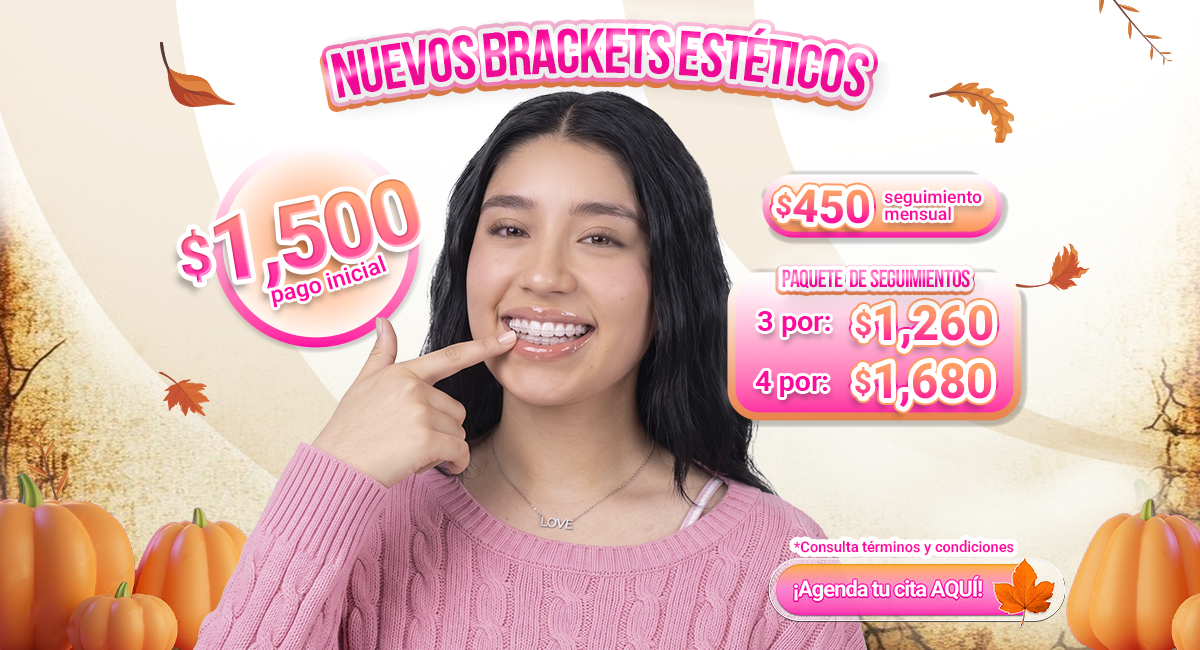 Brackets estéticos disponibles en todo México