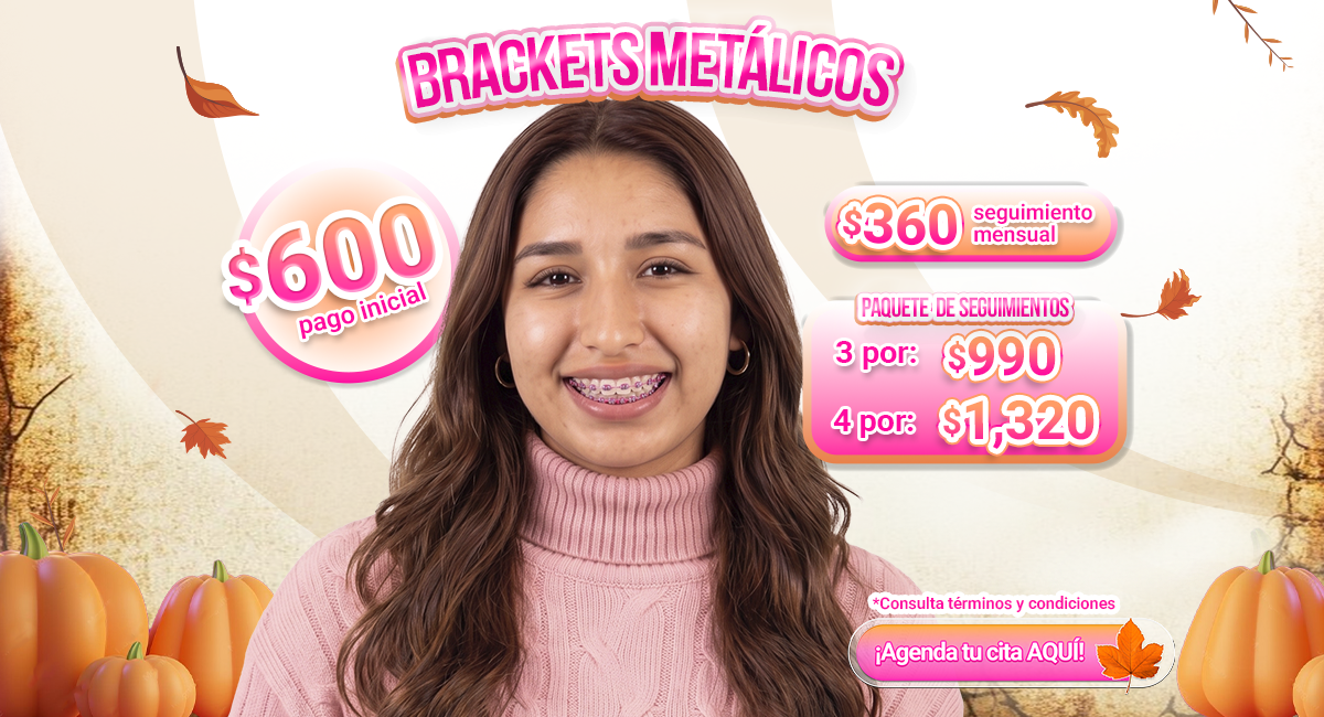 Brackets metálicos disponibles en Ciudad de México
