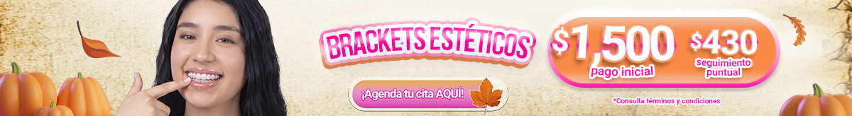 Nuevos alineadores brackets estéticos en nuestras sucursales de Sonrisas Mexicanas