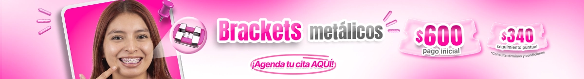Brackes en nuestras sucursales de Sonrisas Mexicanas
