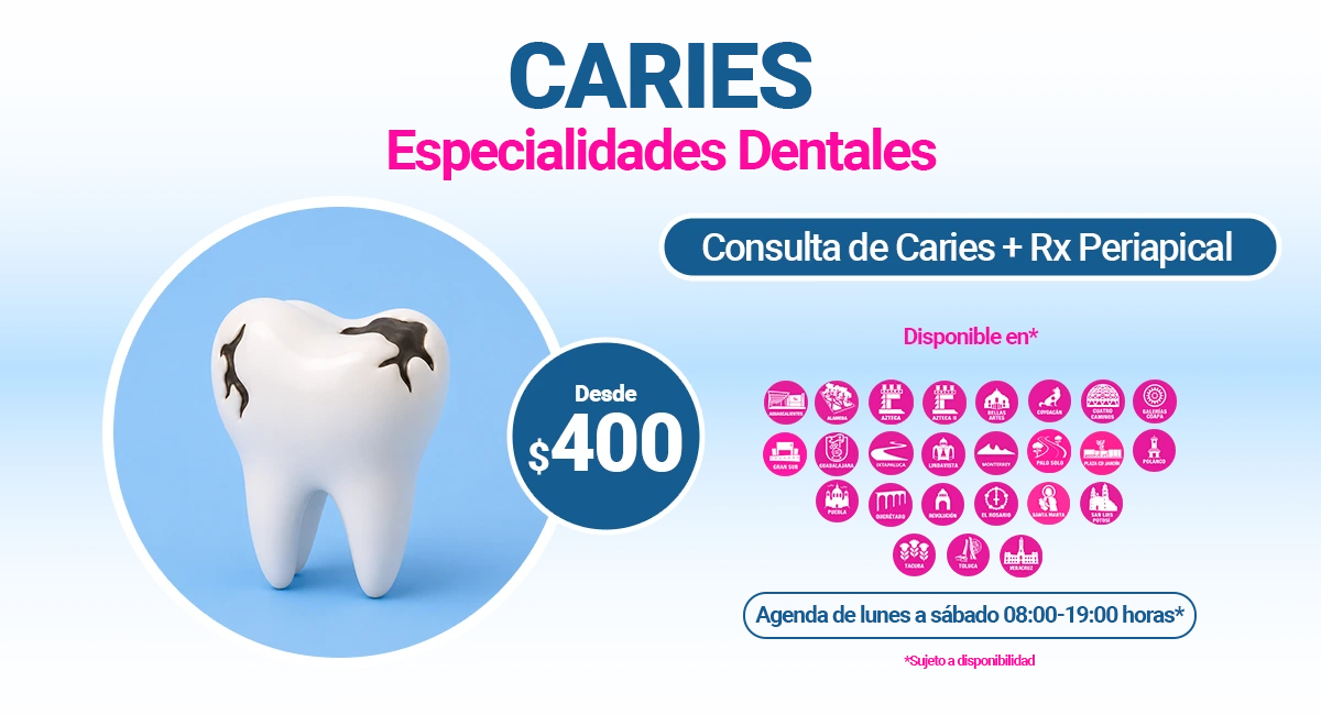 Tratamiento para Caries en Sonrisas Mexicanas
